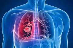 告别右胸腔积液，轻松掌握治疗秘籍